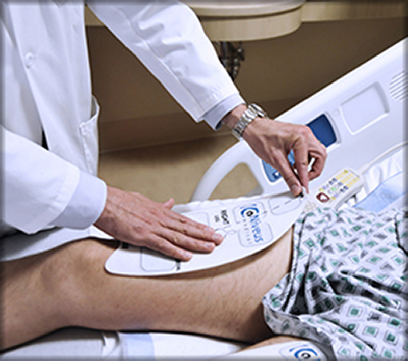 The physician applies the stimulation array pad to the patient's quadriceps as a single unit.