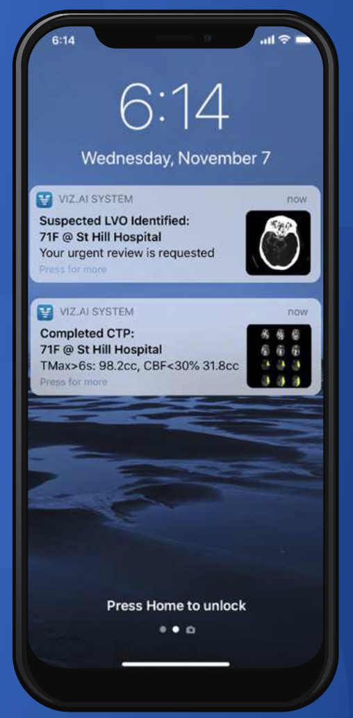 Viz.ai is easily accessible to care providers.